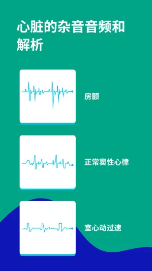 �ĵ�ͼECGԤ��ͼ